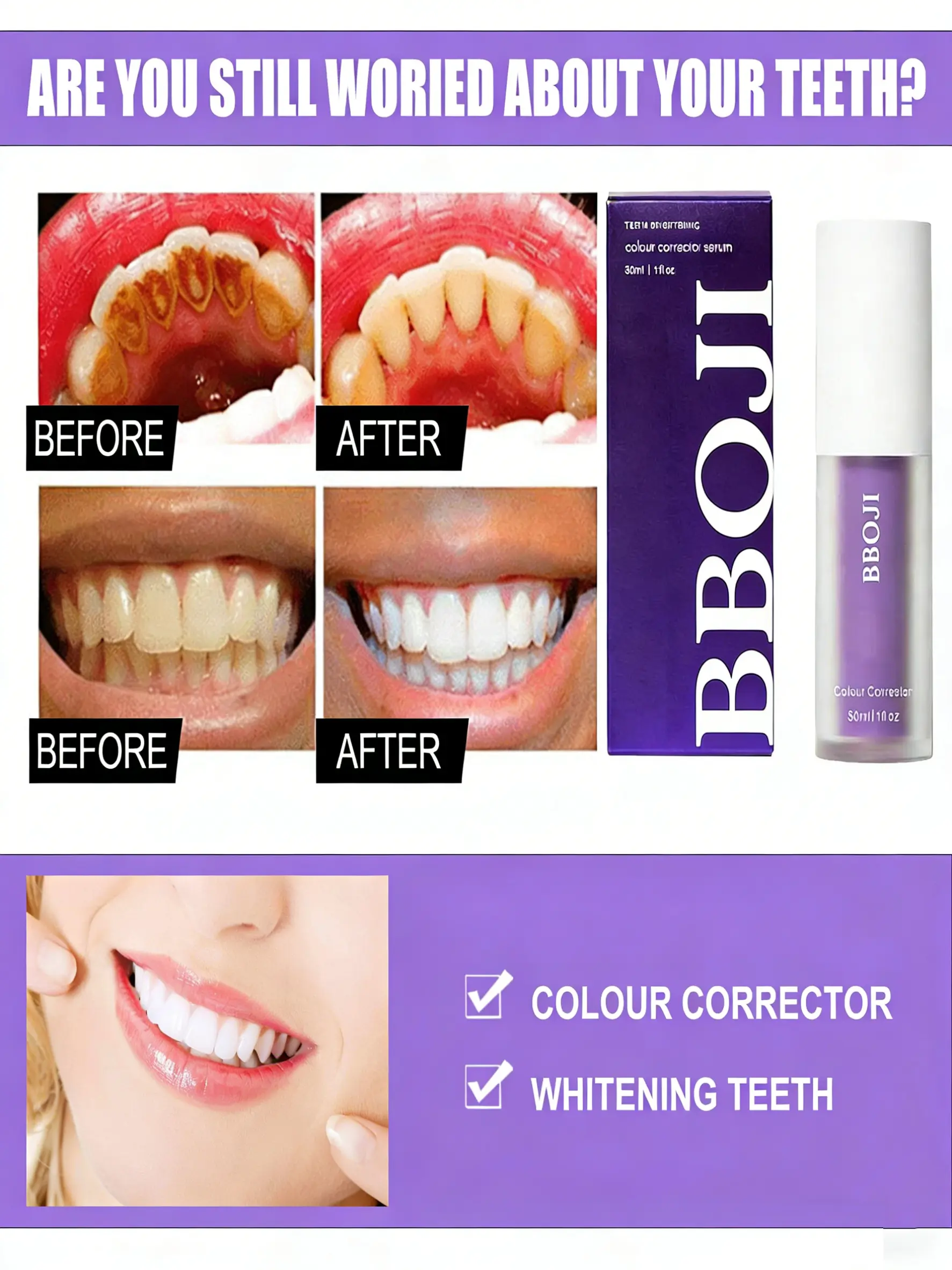 BBOJI Teeth Whitening Gel Colour Corrector - Image 3