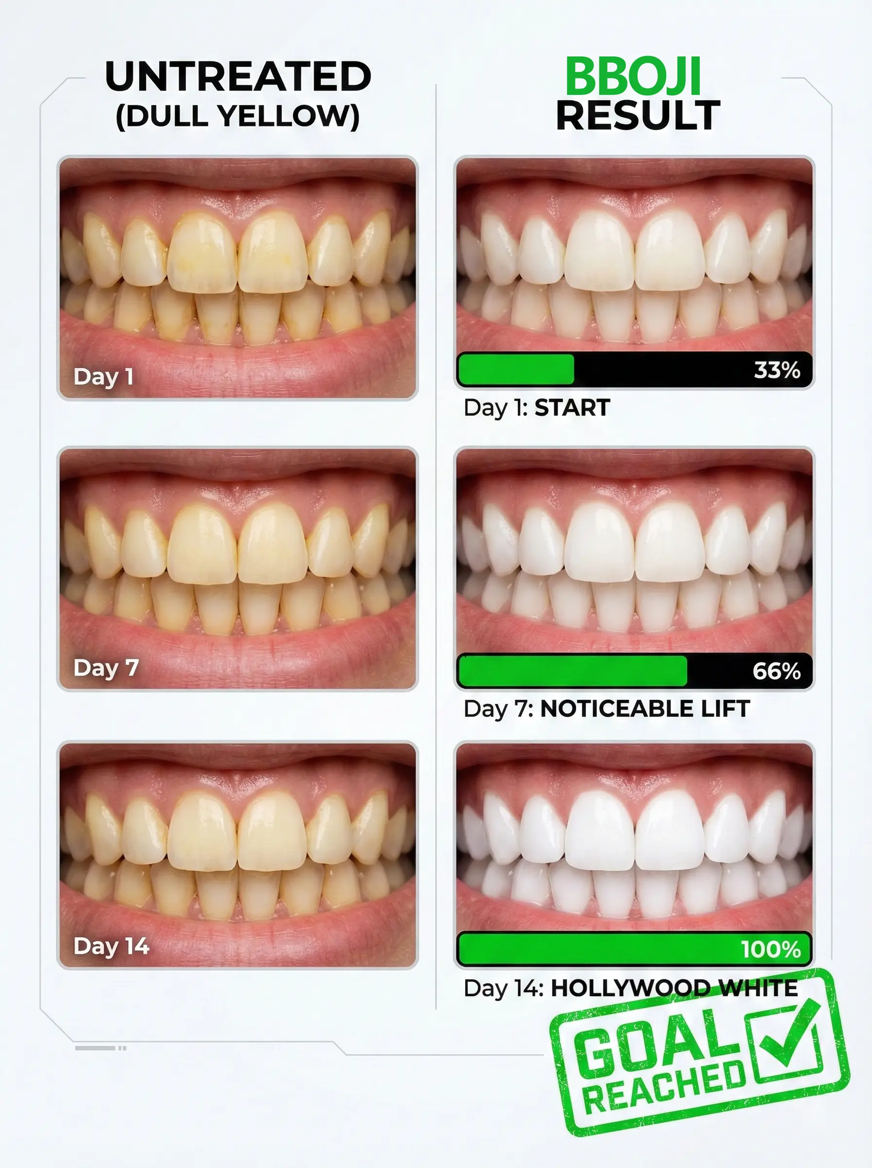 BBOJI Teeth Whitening Gel Colour Corrector - Image 4