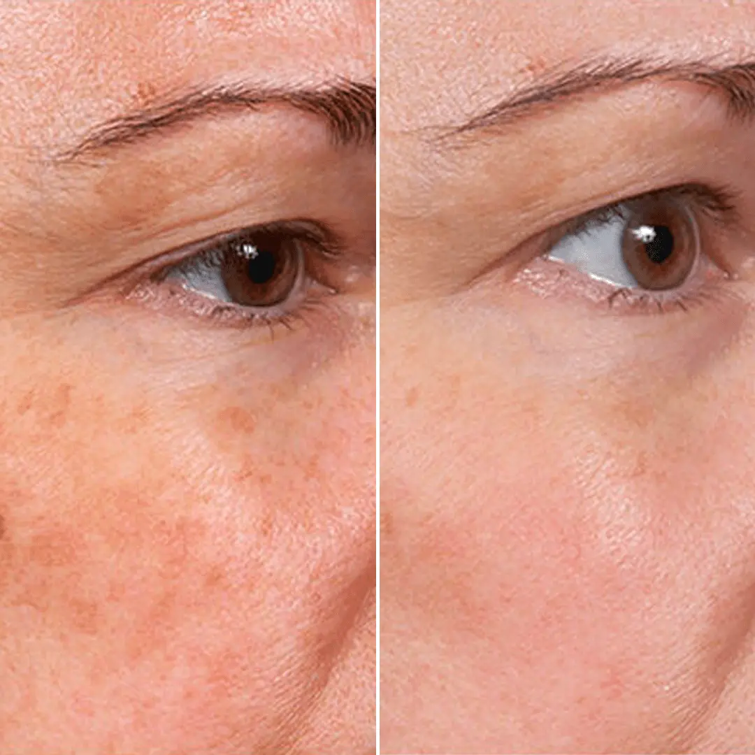 ๏ธ ๐๐ญ๐๐ฆ ๐๐๐ฅ๐ฅโ๐๐ง๐ฌ๐ฉ๐ข๐ซ๐๐ &Blue Copper Peptide ๐๐ซ๐ข๐ง๐ค๐ฅ๐-๐๐๐๐ข๐ง๐ข๐ง๐ ๐๐๐ซ๐ฎ๐ฆ - Image 10