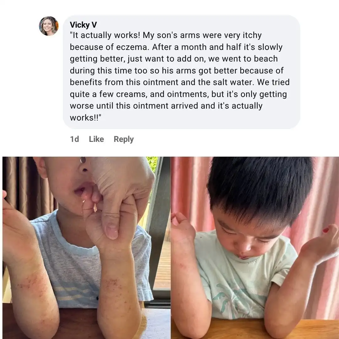 The Steroid-Free Daily Cream for Eczema-Prone, Sensitive Skin - Image 5