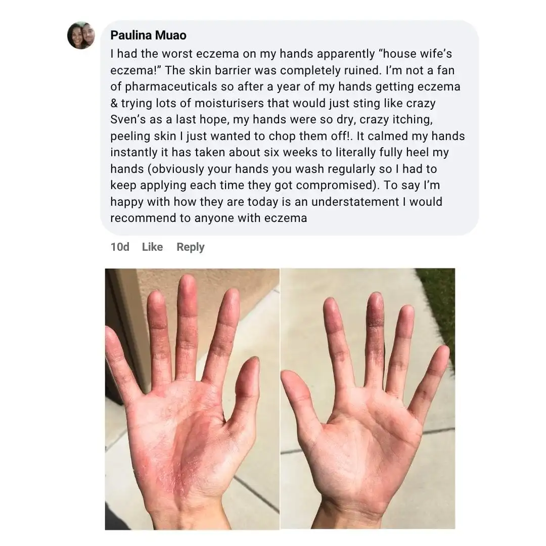 The Steroid-Free Daily Cream for Eczema-Prone, Sensitive Skin - Image 6